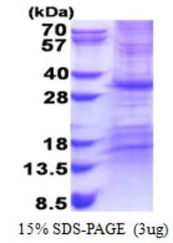 Novus Biologicals&trade;&nbsp;Recombinant Human CHCHD3 His Protein