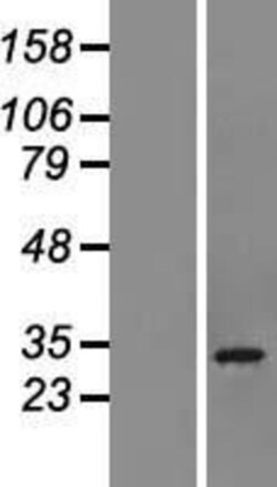 Novus Biologicals&trade;&nbsp;CHCHD6 Overexpression Lysate