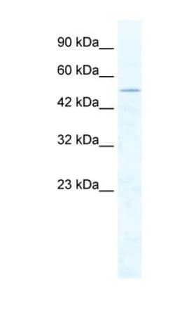 CHD1L Antibody, Novus Biologicals 100&mu;L; Unlabeled:Antibodies, Polyclonal