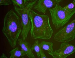 CHD4 Antibody, Novus Biologicals 0.1mL; Unlabeled:Antibodies, Polyclonal