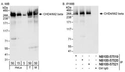 CHD4 Antibody, Novus Biologicals 0.1mL; Unlabeled:Antibodies, Polyclonal