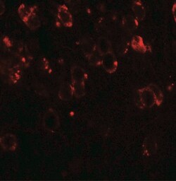 CHD7 Antibody - BSA Free, Novus Biologicals:Antibodies:Primary Antibodies