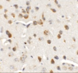 CHD7 Antibody - BSA Free, Novus Biologicals:Antibodies:Primary Antibodies