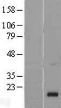 Novus Biologicals&trade;&nbsp;Chemerin Overexpression Lysate