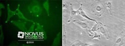 Novus Biologicals™ Chemotherapy Insensitive Tumor Cells Antibody Pack