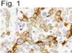 Novus Biologicals Chemotherapy Insensitive Tumor Cells Antibody Pack 4