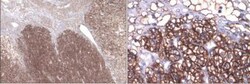Novus Biologicals Chemotherapy Insensitive Tumor Cells Antibody Pack 4