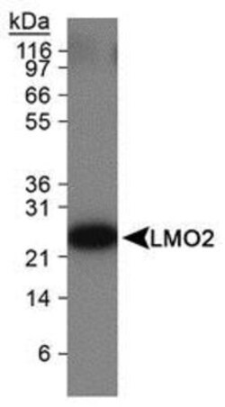 Novus Biologicals Chemotherapy Insensitive Tumor Cells Antibody Pack 4