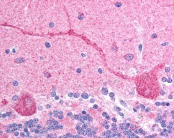 CHFR Antibody, Novus Biologicals 0.1mg; Unlabeled:Antibodies, Polyclonal