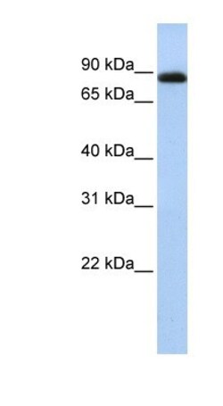 CHFR Antibody, Novus Biologicals 100&mu;L; Unlabeled:Antibodies, Polyclonal