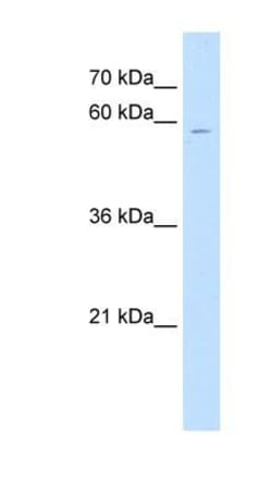 ChGn Antibody, Novus Biologicals 100μL; Unlabeled:Antibodies, Polyclonal