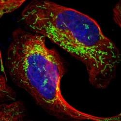 Chitinase 3-like 2 Antibody, Novus Biologicals 25 &mu;L; Unlabeled:Antibodies,