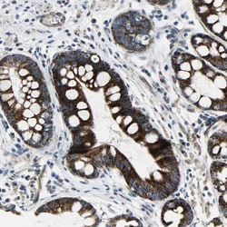 Chitinase 3-like 2 Antibody, Novus Biologicals 25 &mu;L; Unlabeled:Antibodies,