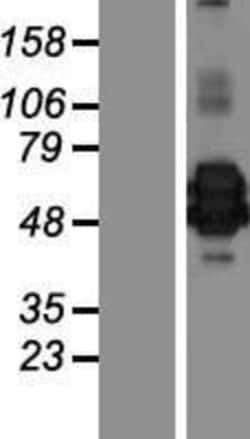 Novus Biologicals&trade;&nbsp;Chitinase 3-like 2 Overexpression Lysate