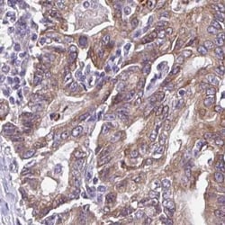 AMCase/CHIA Antibody, Novus Biologicals 0.1mL; Unlabeled:Antibodies, Polyclonal