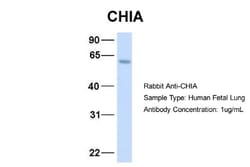 AMCase/CHIA Antibody, Novus Biologicals:Antibodies:Primary Antibodies