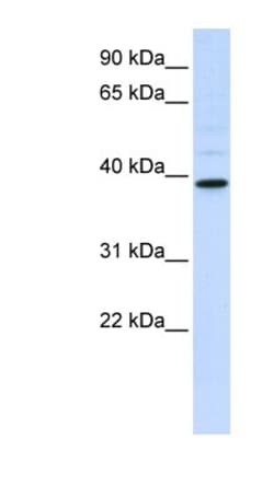 AMCase/CHIA Antibody, Novus Biologicals 100 &mu;L | Buy Online | Novus Biologicals | Fisher Scientific