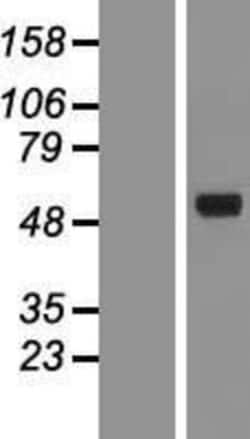 Novus Biologicals&trade;&nbsp;AMCase/CHIA Overexpression Lysate