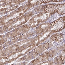 AMCase/CHIA Antibody, Novus Biologicals 0.1mL; Unlabeled:Antibodies, Polyclonal