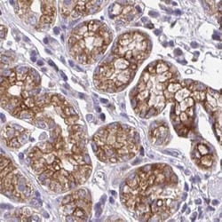 AMCase/CHIA Antibody, Novus Biologicals 0.1mL; Unlabeled:Antibodies, Polyclonal