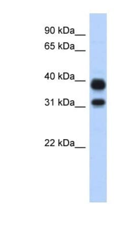 AMCase/CHIA Antibody, Novus Biologicals:Antibodies:Primary Antibodies