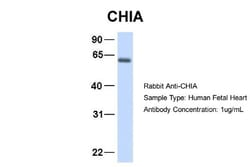 AMCase/CHIA Antibody, Novus Biologicals:Antibodies:Primary Antibodies