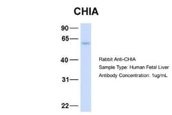 AMCase/CHIA Antibody, Novus Biologicals:Antibodies:Primary Antibodies