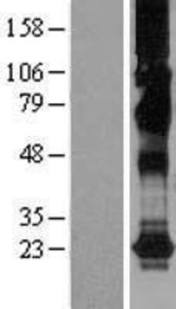 Novus Biologicals&trade;&nbsp;CHIC2 Overexpression Lysate