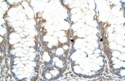 CHIC2 Antibody, Novus Biologicals:Antibodies:Primary Antibodies