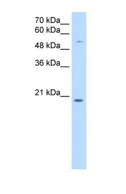 CHIC2 Antibody, Novus Biologicals:Antibodies:Primary Antibodies