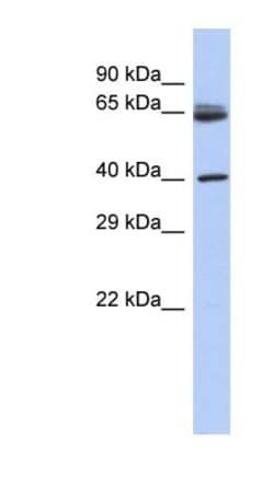 Chimaerin 2 Antibody, Novus Biologicals 100&mu;L; Unlabeled:Antibodies,