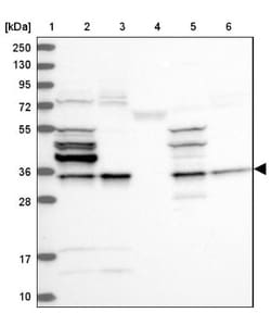 CHIP/STUB1 Antibody, Novus Biologicals:Antibodies:Primary Antibodies