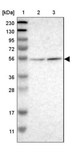 Chitotriosidase/CHIT1 Antibody, Novus Biologicals:Antibodies:Primary Antibodies