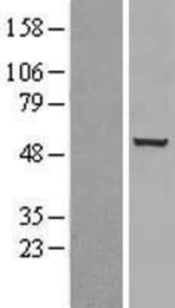 Novus Biologicals&trade;&nbsp;Chk1 Overexpression Lysate