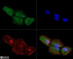 Chk1 Antibody (2G1D5) - BSA Free, Novus Biologicals 0.025mL; Unlabeled:Antibodies,