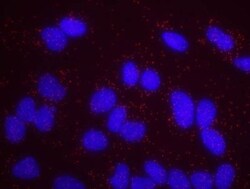 Chk1 Antibody, Novus Biologicals 0.1mg; Unlabeled:Antibodies, Polyclonal