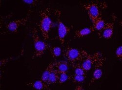 Chk1 Antibody, Novus Biologicals 0.1mg; Unlabeled:Antibodies, Polyclonal