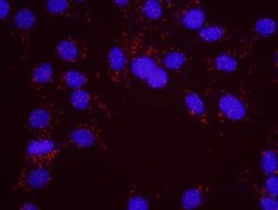 Chk1 Antibody, Novus Biologicals 0.1mg; Unlabeled:Antibodies, Polyclonal