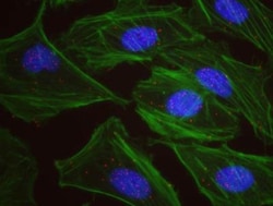 Chk1 Antibody, Novus Biologicals 0.1mg; Unlabeled:Antibodies, Polyclonal