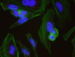 Chk1 Antibody, Novus Biologicals 0.1mg; Unlabeled:Antibodies, Polyclonal