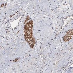 BST2 Antibody, Novus Biologicals:Antibodies:Primary Antibodies