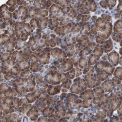 CHM Antibody, Novus Biologicals 25ul | Buy Online | Novus Biologicals | Fisher Scientific