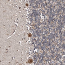 CHML Antibody, Novus Biologicals:Antibodies:Primary Antibodies