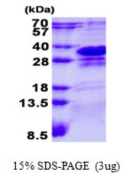 Novus Biologicals&trade;&nbsp;Recombinant Human CHMP1a His Protein