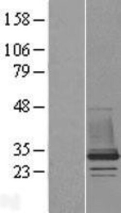 Novus Biologicals&trade;&nbsp;CHMP1B Overexpression Lysate