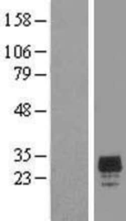Novus Biologicals&trade;&nbsp;CHMP2A Overexpression Lysate