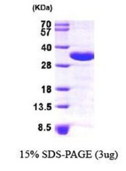 Novus Biologicals&trade;&nbsp;Recombinant Human CHMP2A His Protein