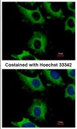 CHMP2B Antibody, Novus Biologicals 0.1mL; Unlabeled:Antibodies, Polyclonal