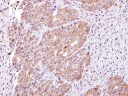 CHMP5 Antibody, Novus Biologicals 0.1mL; Unlabeled:Antibodies, Polyclonal
