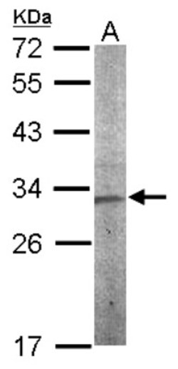 CHMP5 Antibody, Novus Biologicals 0.1mL; Unlabeled:Antibodies, Polyclonal